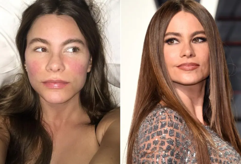 Celebrities Pictured Without Makeup